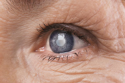 Main Street Eye Care | Emergency Eye Care, Optical Department and Macular Degeneration